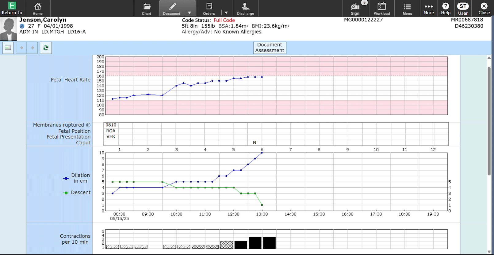 Expanse Partogram screen in the Labor and Delivery solution
