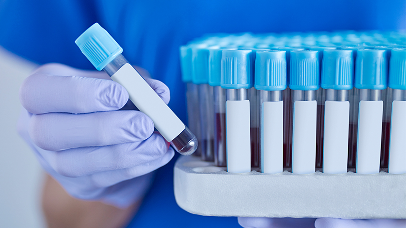 Doctor holding a blood samples